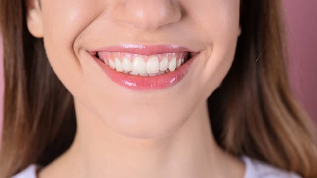 Phẫu thuật cắt lợi bao nhiêu tiền: Chi phí ước tính tại Việt Nam