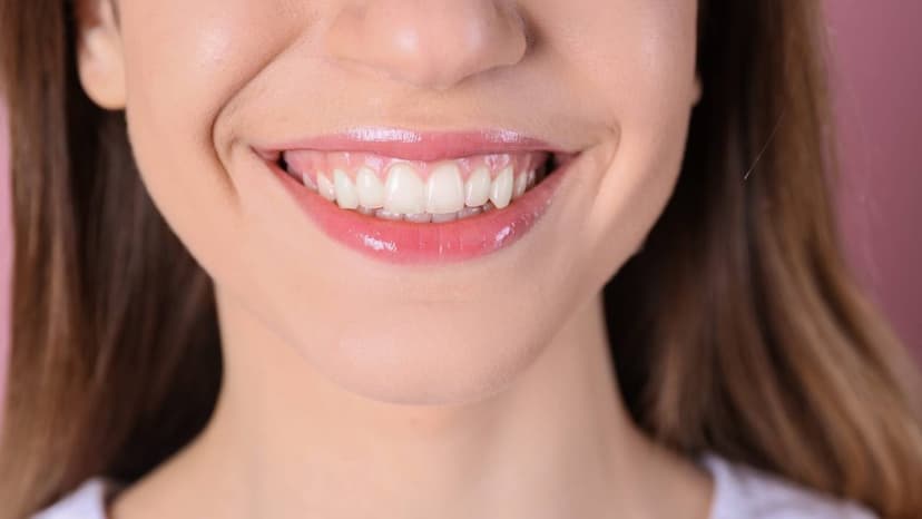 Phẫu thuật cắt lợi bao nhiêu tiền: Chi phí ước tính tại Việt Nam