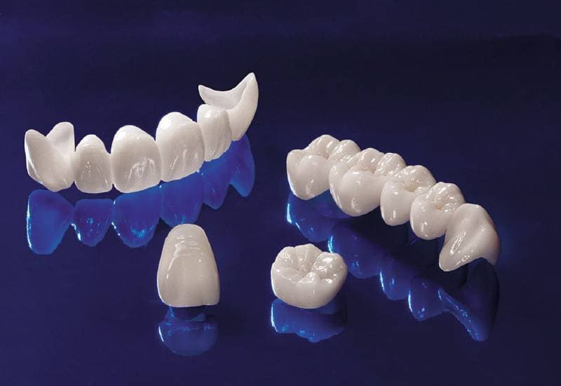 các loại răng sứ cao cấp