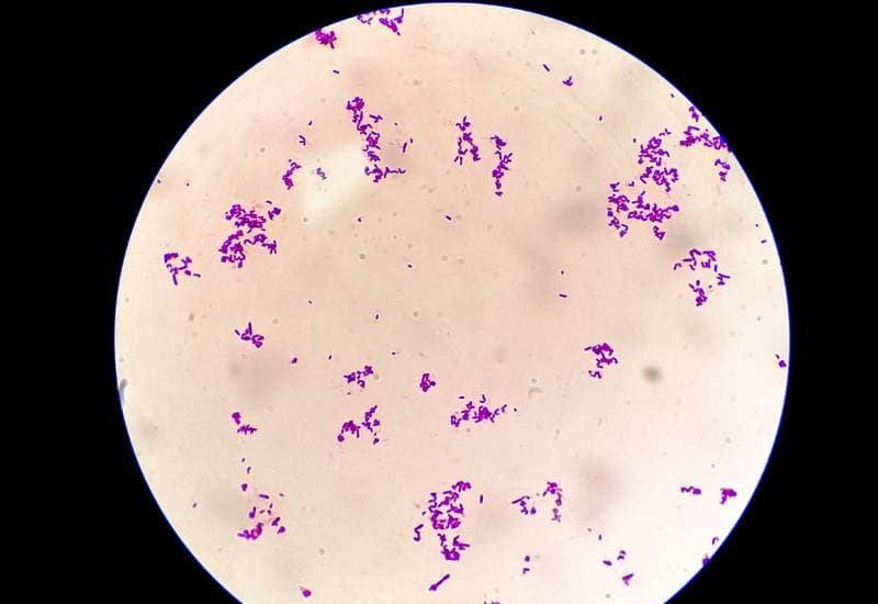 Giải đáp chi tiết thắc mắc: Sâu ăn răng như thế nào?