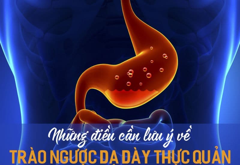 Trào ngược dạ dày nặng là gì?