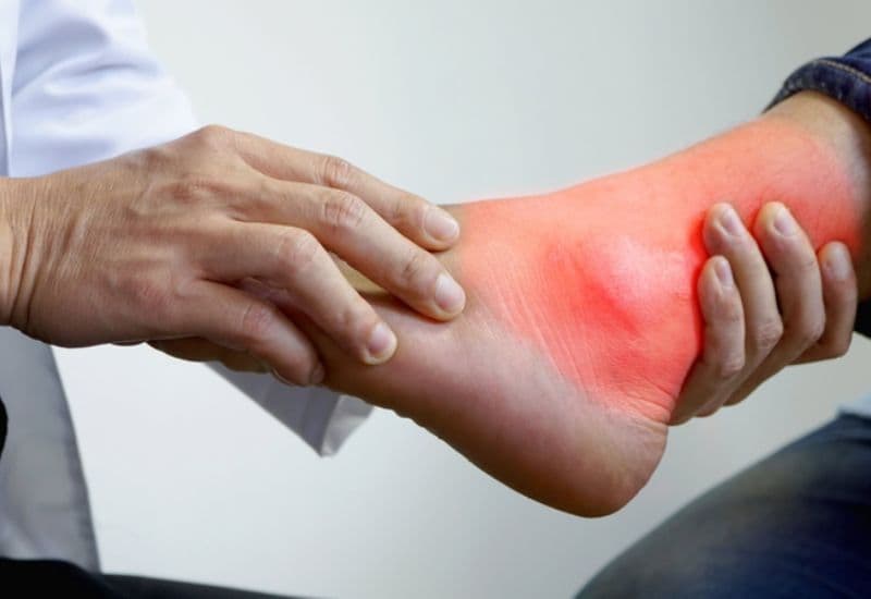 Trật khớp cổ chân khi nào cần khám bác sĩ