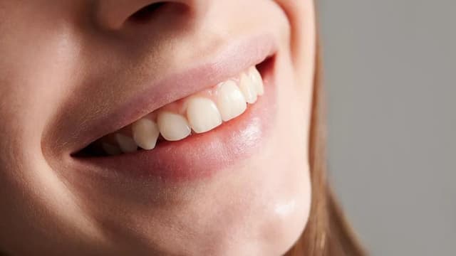 Hướng dẫn chi tiết cách trị cười hở lợi tại nhà