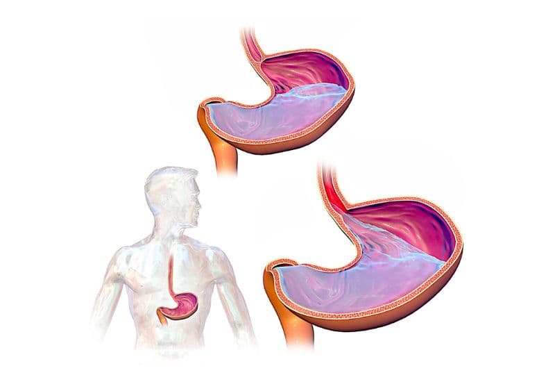 GERD gây triệu chứng đau rát ngực như thế nào?