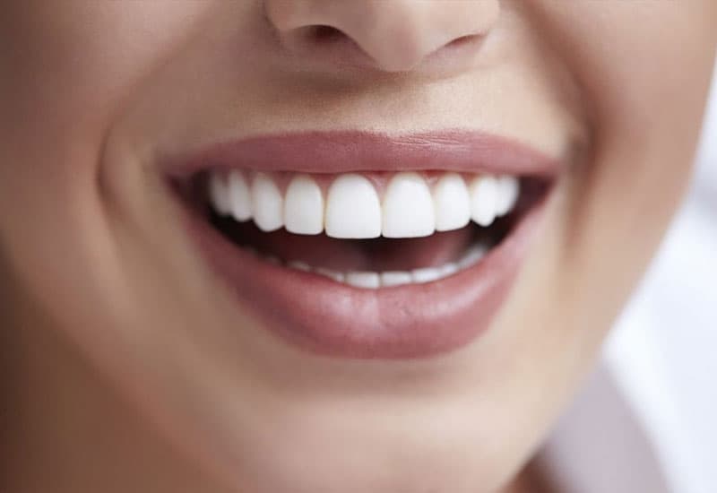 hỏi đáp Trồng răng sứ