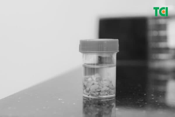 Khối u vú được loại bỏ nhẹ nhàng sau 30 phút, không gây đau đớn.