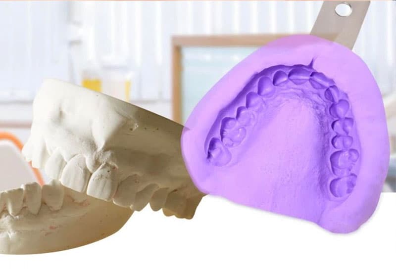 Chi phí up răng sứ