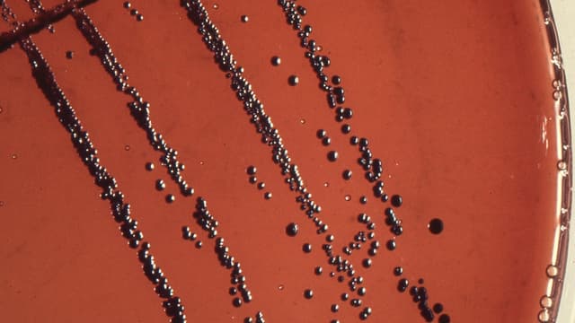 Vi khuẩn bạch hầu: 5 thông tin giải đáp tính chất cực nguy hiểm