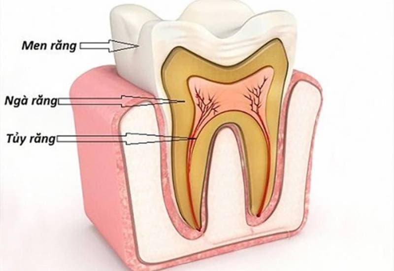 nhận biết viêm tủy chân răng 