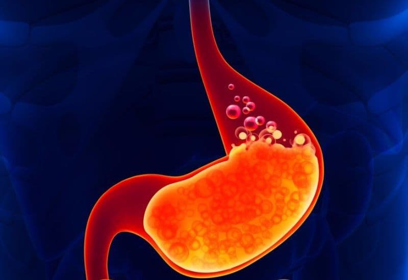 Khám phá các nguyên nhân gây ợ chua sau khi ăn