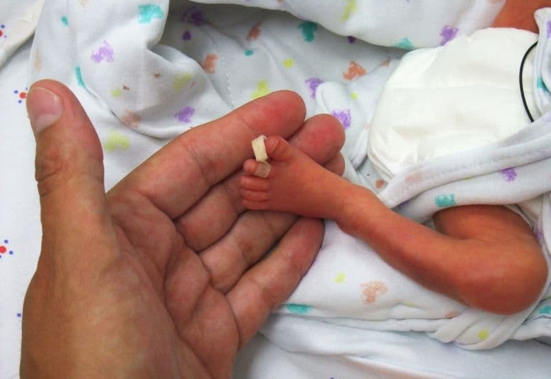 Trẻ sinh non hoặc có vấn đề sức khỏe khi sinh có nguy cơ cao bị mắt lác do hệ thống thị giác chưa phát triển hoàn thiện.