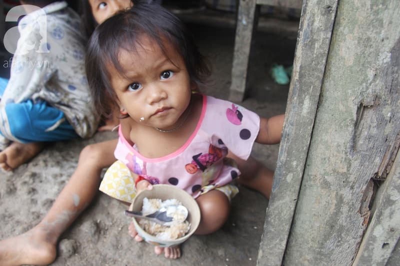 Nguyên nhân trẻ bị bệnh suy dinh dưỡng là gì?