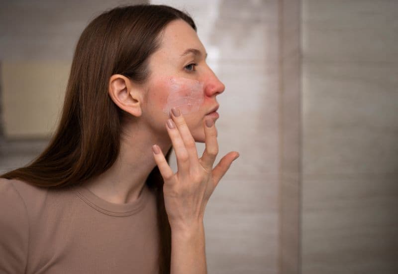 biểu hiện áp xe da