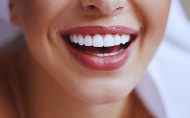 Bọc răng sứ bao nhiêu tiền hả bác sĩ