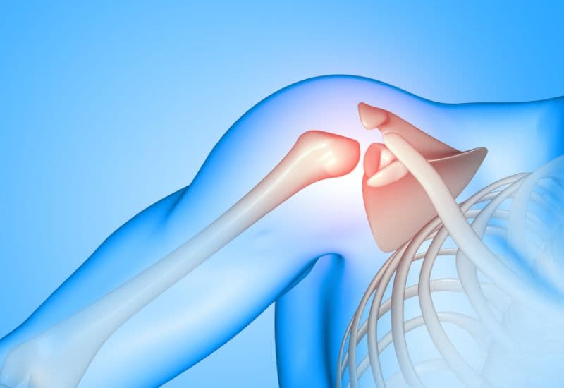 dấu hiệu trật khớp vai