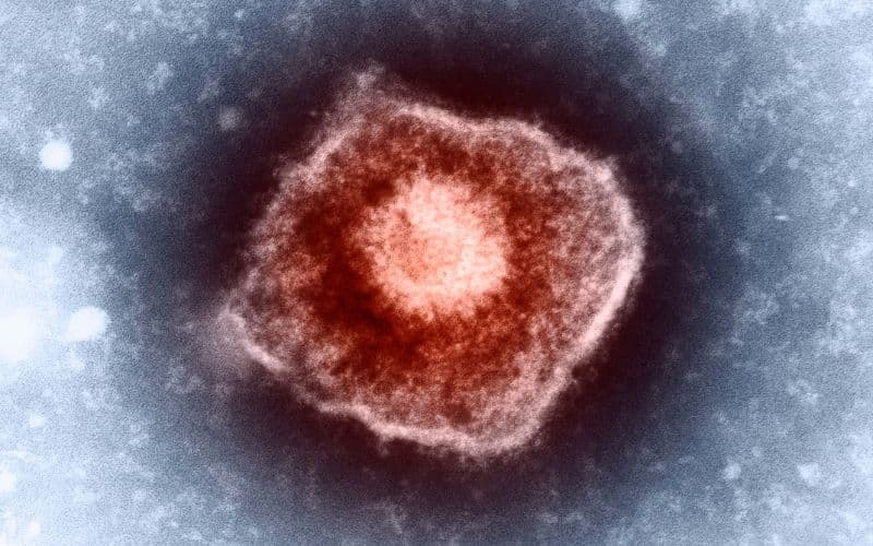 Hình ảnh virus thủy đậu