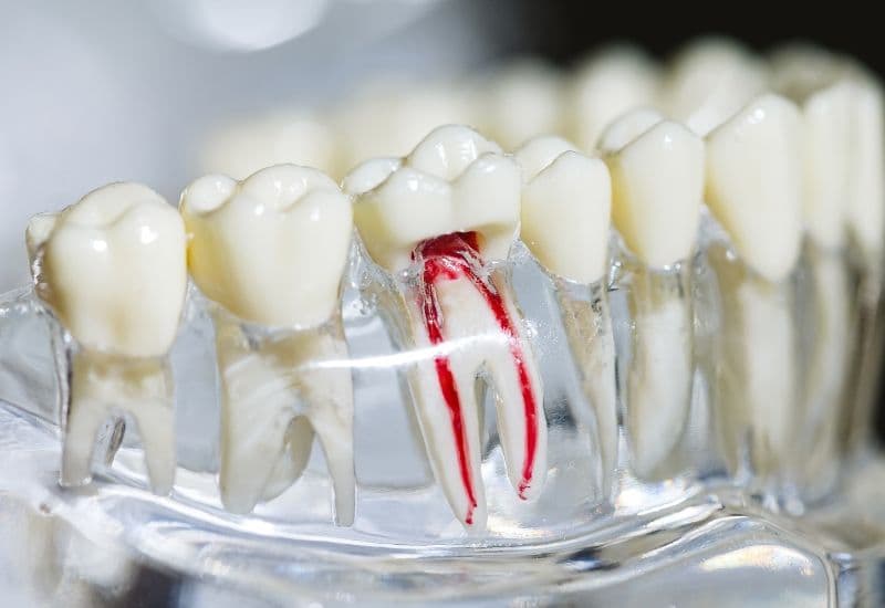 Tủy là phần mềm nằm ở trung tâm của răng, trong một khoang được gọi là kênh tủy, bao quanh bởi ngà răng và cuối cùng là men răng.