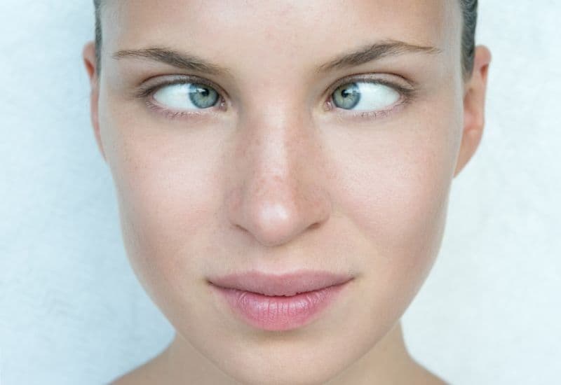 Lác mắt là gì, bạn đã biết hay chưa?