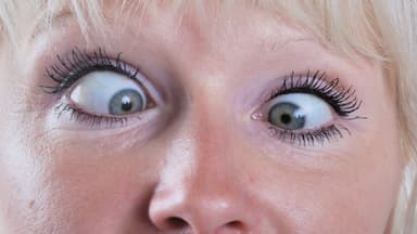 Lác mắt là gì: Nguyên nhân và 5 phương pháp điều trị