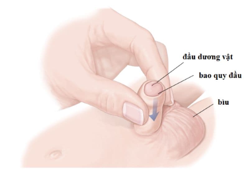 lợi ích cắt bao quy đầu 