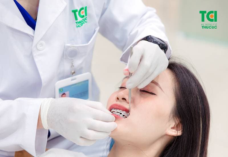 Niềng răng hô hàm trên như thế nào