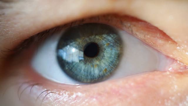 Phẫu thuật nâng cơ mí mắt: 4 phương pháp thường được chỉ định