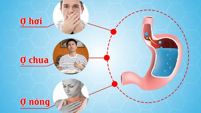 Ứng dụng đo pH thực quản 24 giờ trong chẩn đoán trào ngược axit