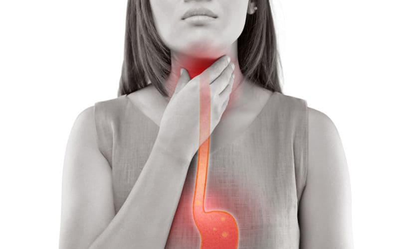 Viêm họng do trào ngược: Thường kèm theo cảm giác nóng rát ở ngực, ợ chua, ợ hơi, và có thể có ho khan