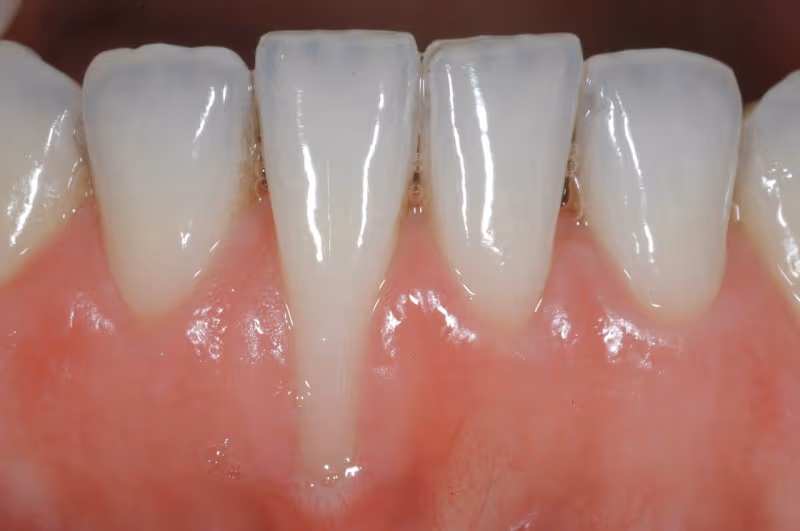 Để càng lâu thì tình trạng này sẽ càng trở nên nghiêm trọng hơn.