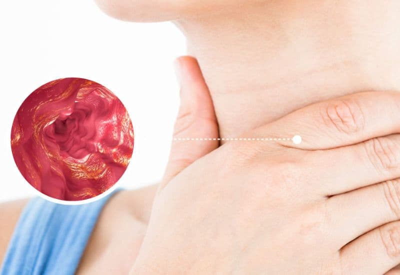 Các biến chứng tiềm ẩn của trào ngược gây đắng miệng