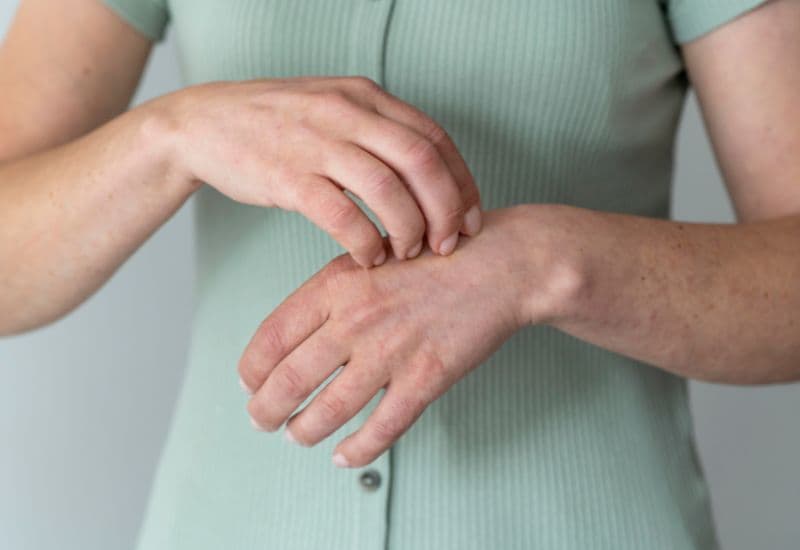 Các dạng phát ban thường gặp sau khi tiêm vắc-xin