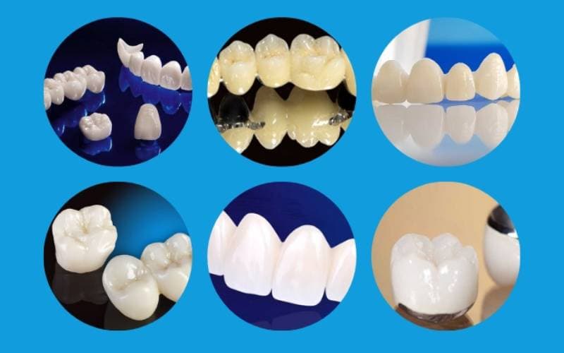 bọc răng sứ thông thường giá bao nhiêu 1 chiếc bình thường