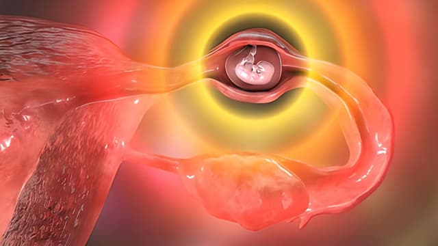 Chửa ngoài tử cung nguy hiểm thế nào và cách nhận biết sớm