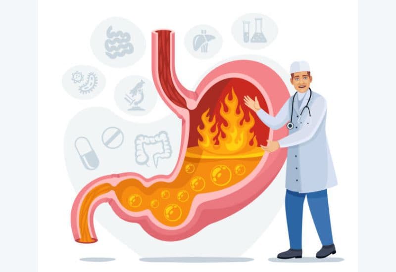Ợ chua sau khi ăn có phải hiện tượng bình thường?