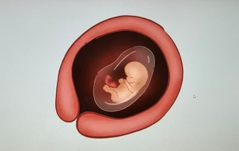 Mẹ bầu đau mắt đỏ mùa mưa lũ nhiều, vì sao?