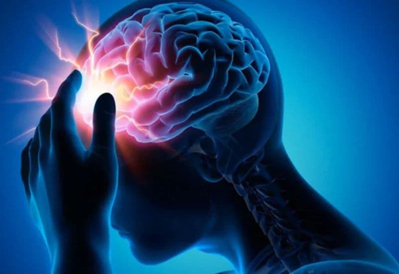 Phình mạch não là gì?