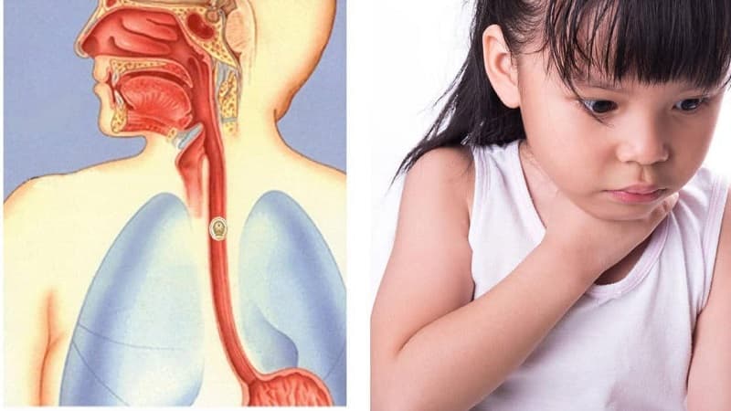 Người già, trẻ em là những đối tượng dễ bị nuốt nghẹn ở họng