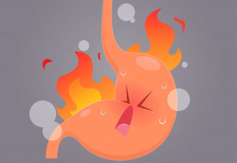 Đi sâu và mối liên hệ giữa viêm loét dạ dày và ợ chua