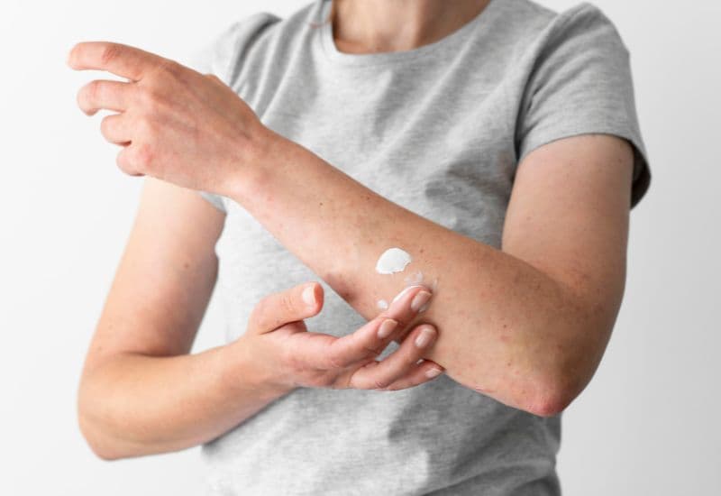 Cách xử lý các phản ứng phụ sau khi tiêm vắc-xin