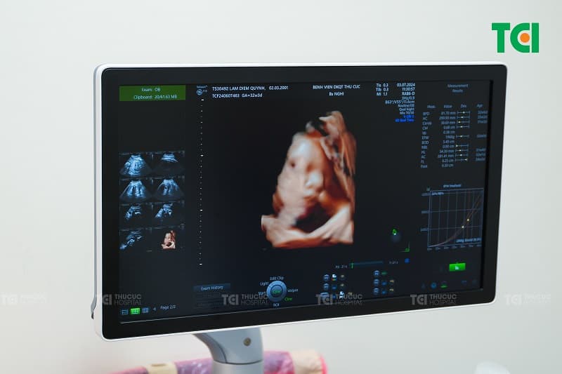 Công nghệ 5D cho hình ảnh sắc nét