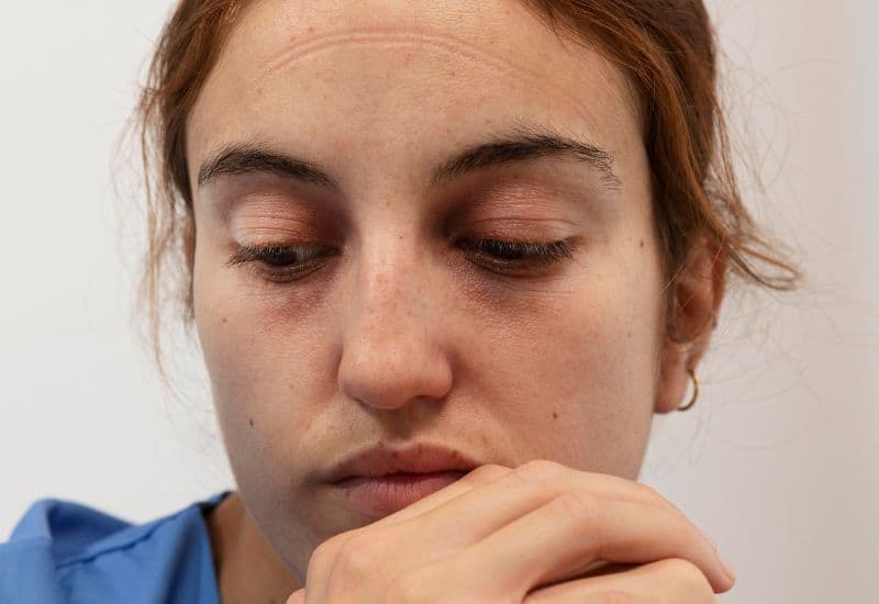 Bạn có thể cảm thấy da xung quanh mắt căng phồng, đôi khi đi kèm cảm giác khó chịu hoặc đau. 