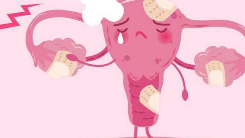 U nang buồng trứng xoắn do đâu?