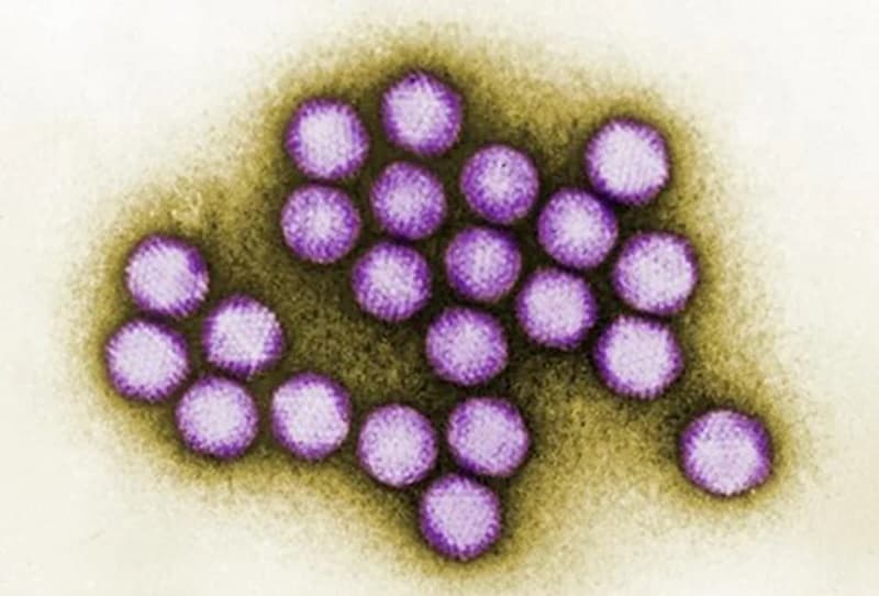 Hình ảnh virus đau mắt đỏ qua kính hiển vi