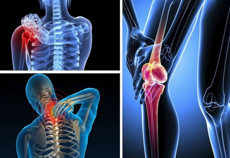 Cách dùng Celebrex