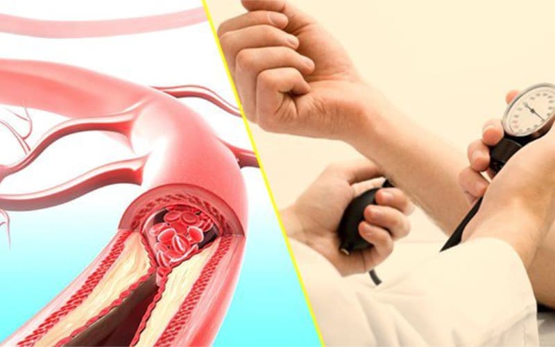 chỉ định của Coversyl