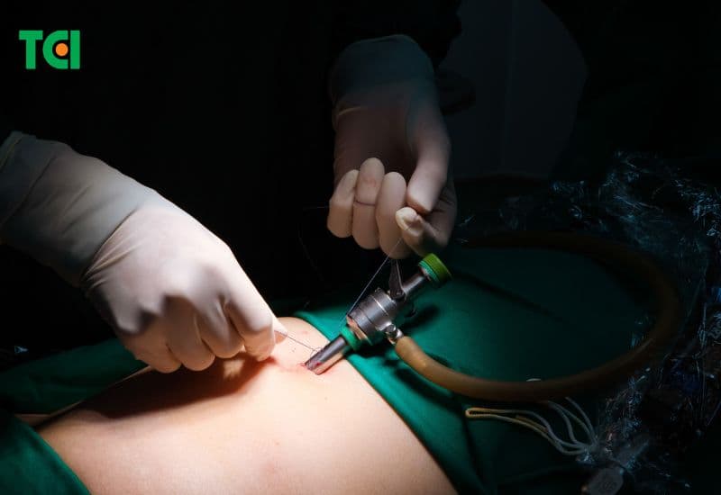 biểu hiện thoát vị bẹn và cách điều trị