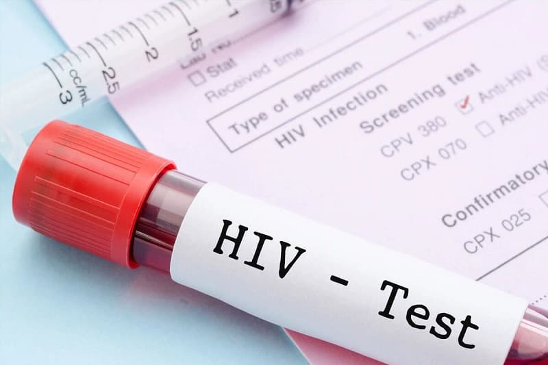 Tình dục không an toàn, HIV gõ cửa