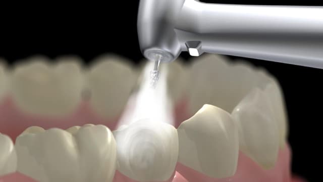 Tìm kiếm địa chỉ lấy cao răng uy tín và câu trả lời