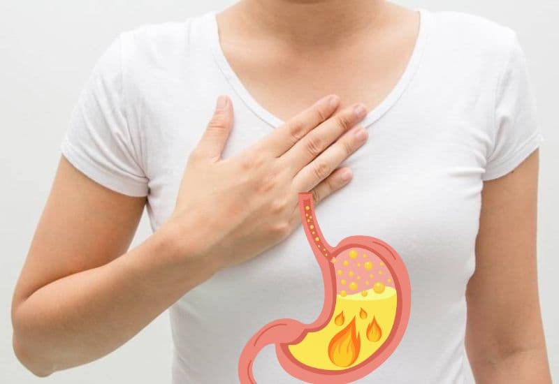 Trào ngược dạ dày - thực quản gây ợ chua đắng miệng