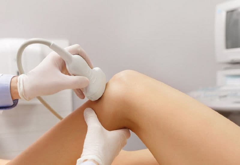 siêu âm chẩn đoán trật khớp đầu gối